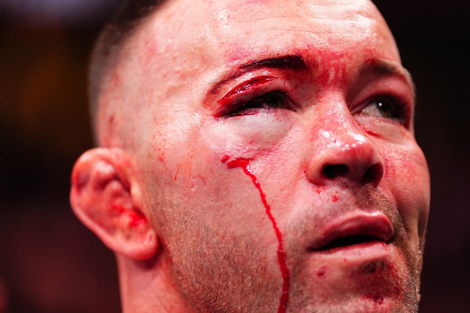 Covington suffered a brutal cut above his eye